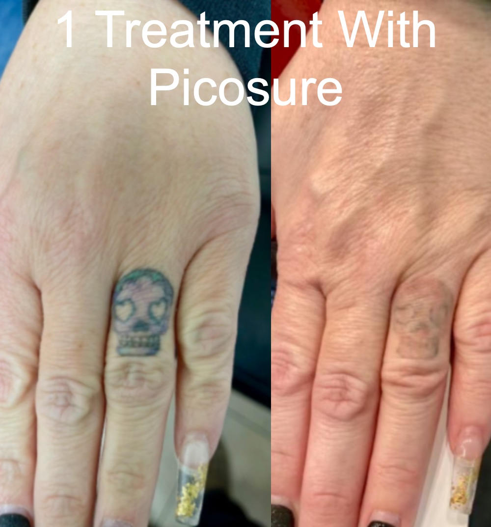 Nuskin Laser & Tattoo Removal logo
